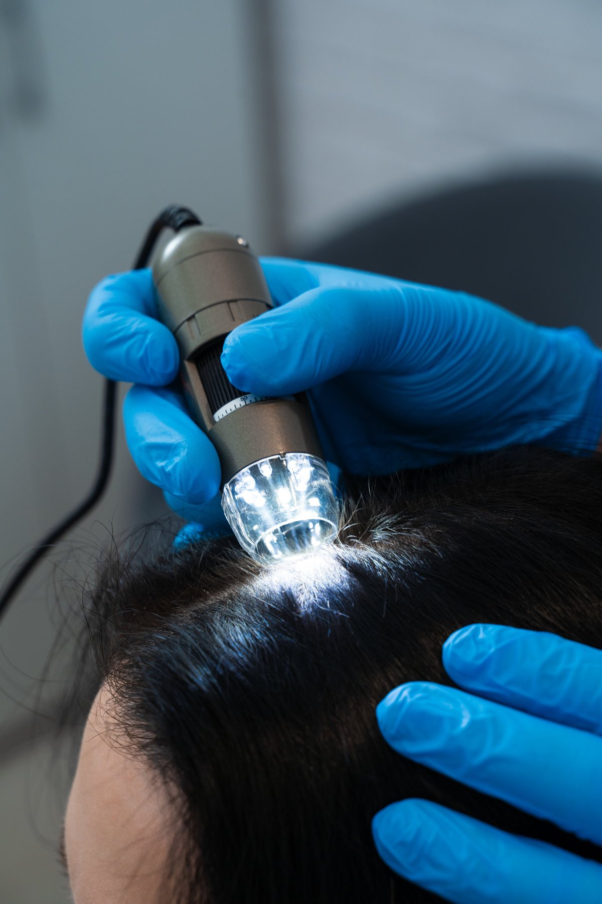 Digital trichoscopy examination for hair follicles and scalp analysis